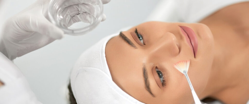 Chemical peels