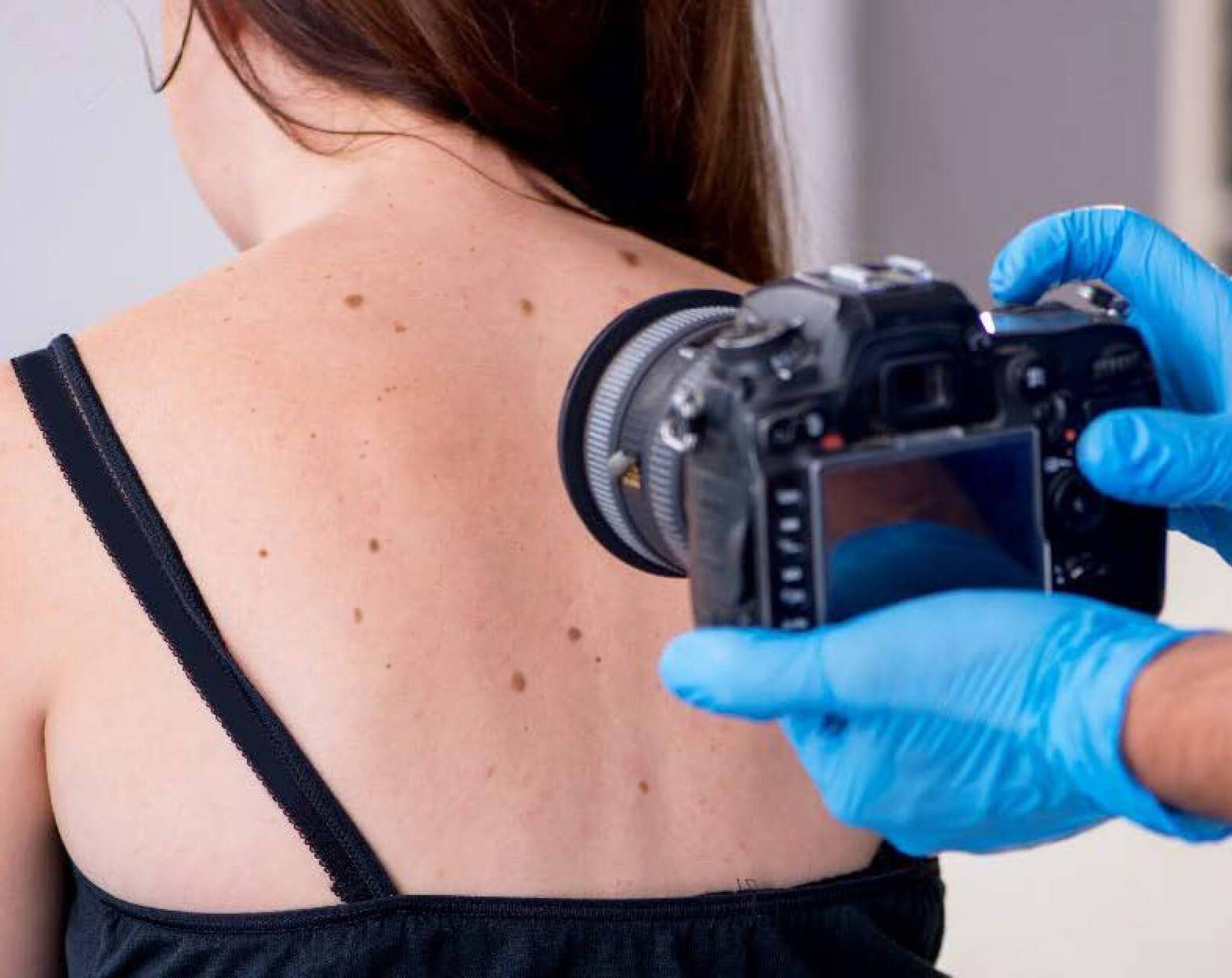 Photographing a body for skin ailments